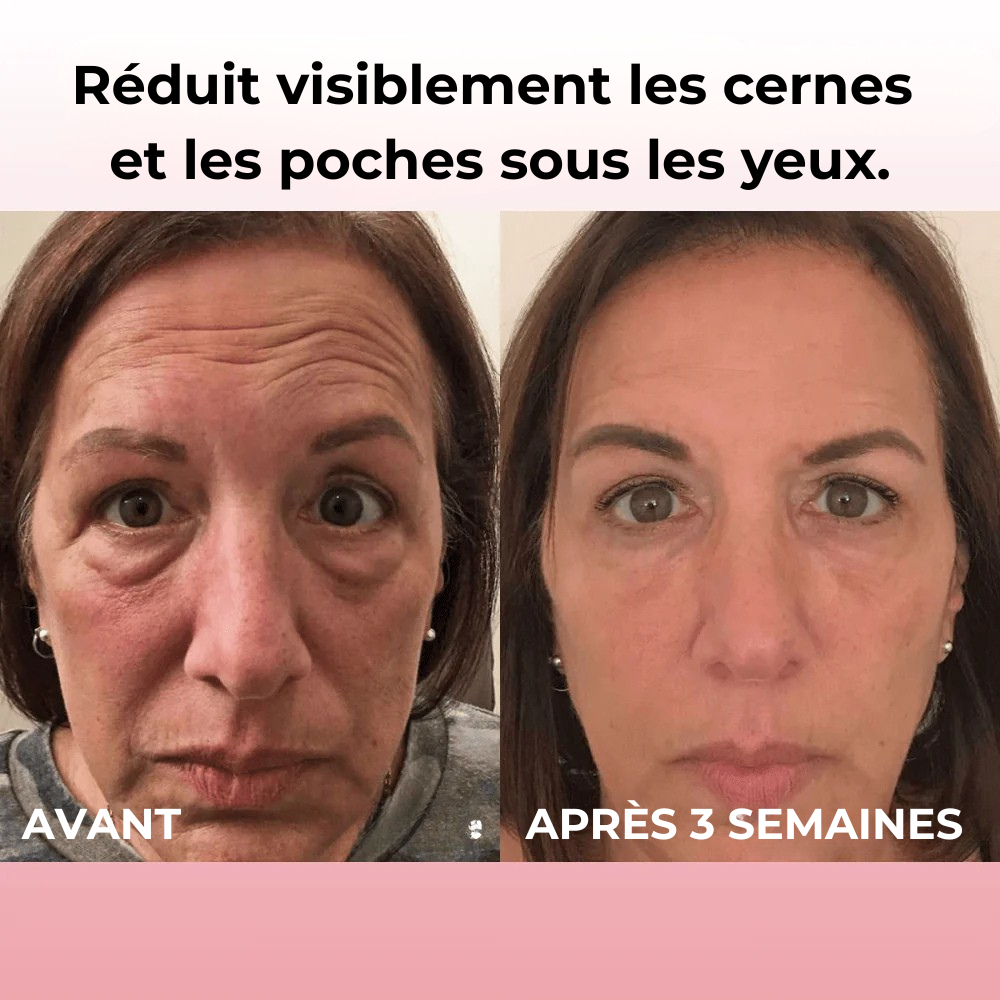 SkinSublime - Patchs pour réduire cernes, poches et fatigue