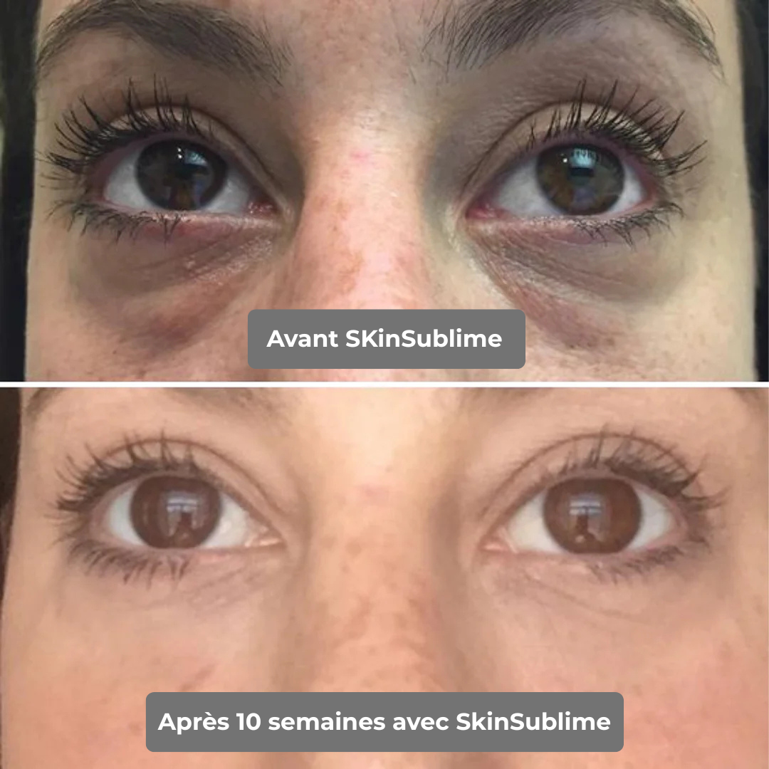 SkinSublime - Patchs pour réduire cernes, poches et fatigue