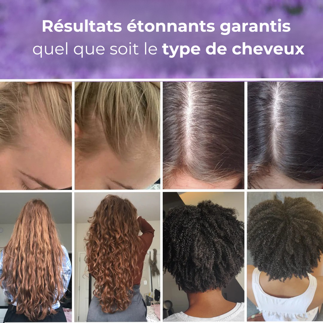 HairPulse - Brosse LED repousse cheveux