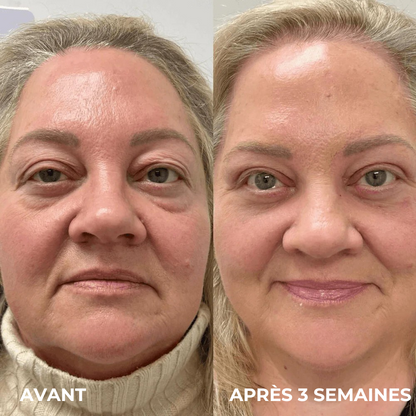 SkinSublime - Patchs pour réduire  cernes, poches et fatigue