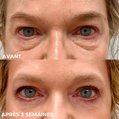 SkinSublime - Patchs pour réduire  cernes, poches et fatigue
