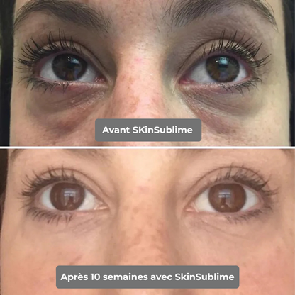 SkinSublime - Patchs pour réduire  cernes, poches et fatigue